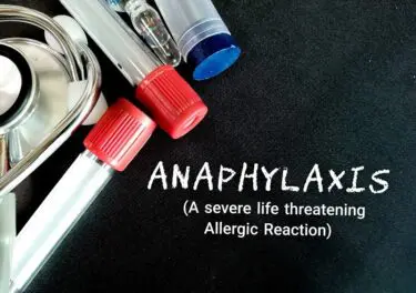 Casus 14 - Quinckslag - anaphylaxis, anafylactische reactie