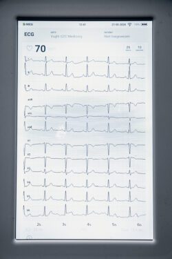 iPad met uitslag ECG